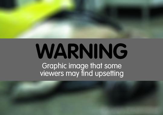 Warning - graphic image