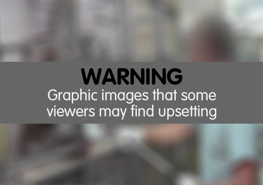 Warning graphic images that some viewers may find upsetting