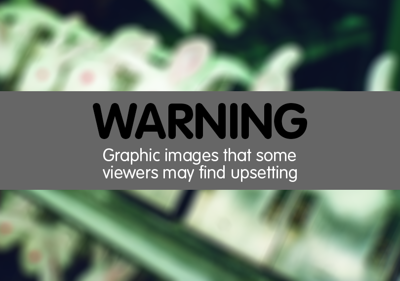 Warning - graphic images that some viewers may find upsetting.